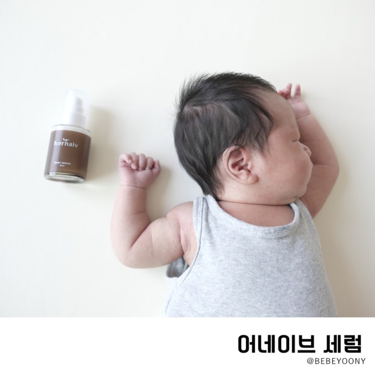  신생아 목땀띠 아기 태열에 어네이브 세럼 5일차 벌써?