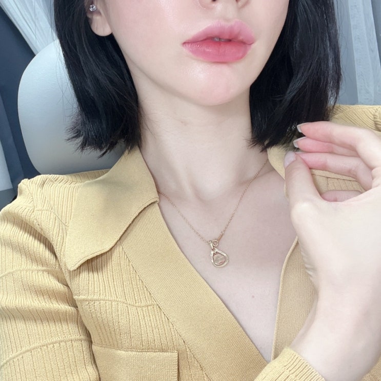  울쎄라 리프팅 100샷 팔자주름 쪽 맞은후기