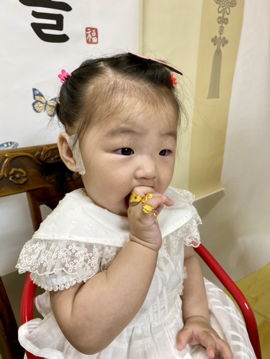 내돈내애 스킨텍 제거 수술후기_부이주 제거 수술고민, 이뽀라성형외과 찐후기 내돈내애 스킨텍 제거 수술후기_부이주 제거 수술고민, 이뽀라성형외과 찐후기