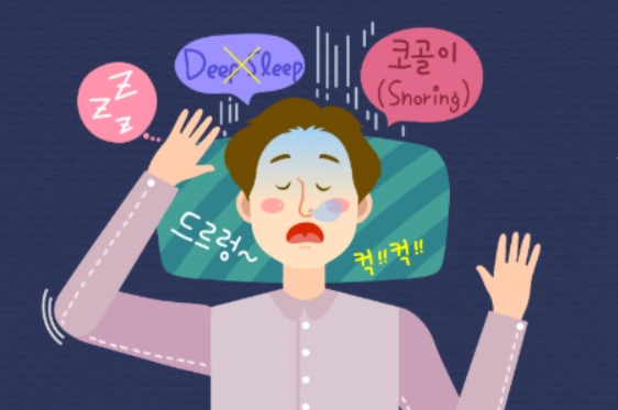  성인 수면호흡장애 (1) - 코골이(Snoring), 수면무호흡증(Obstructive sleep apnea syndrome, OSAS)의 정의, 분류, 기전, 증상, 합병증