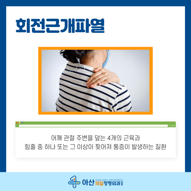 강릉정형외과 어깨관절와순파열 특징은? 3