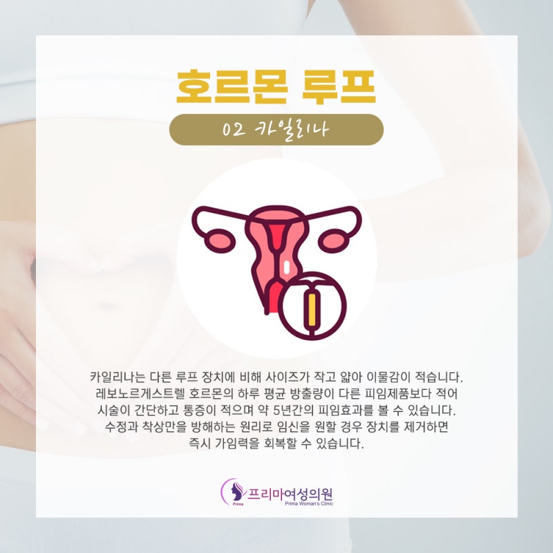 미레나피임효과 나에게 필요한 7