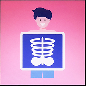 AXA실비보험 도수치료 금액과 함께 알아보세요 AXA실비보험 도수치료 금액과 함께 알아보세요