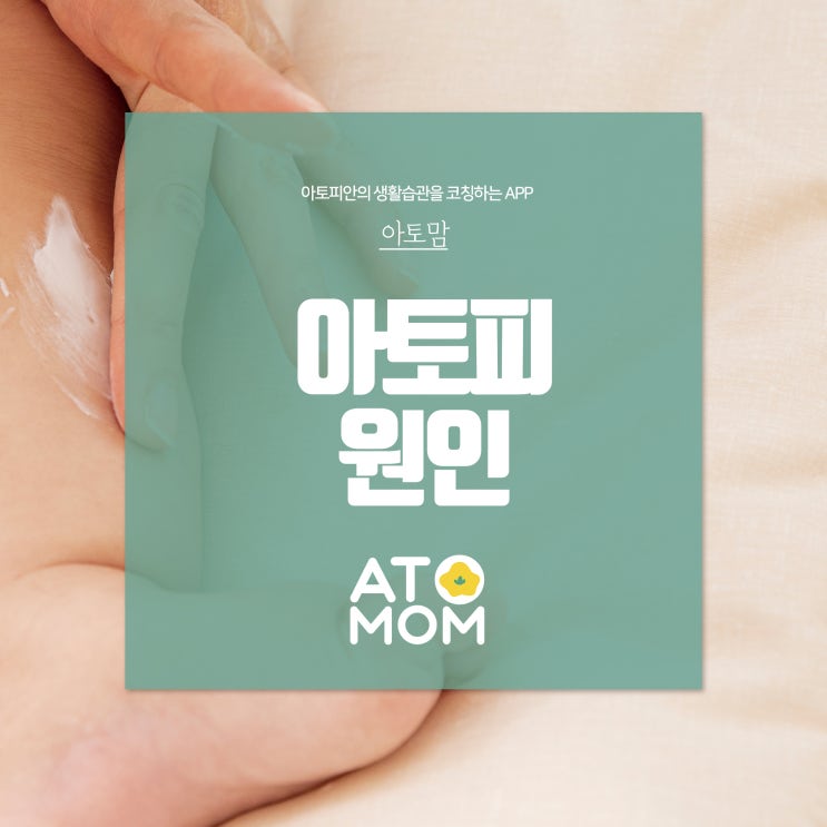  아토피 원인 아토맘에서 꾸준히 관리해요