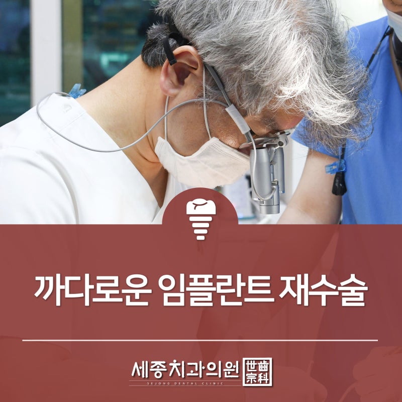 부산 임플란트 치과 세종치과 임플란트 스토리 - 엄격한 임플란트 재수술