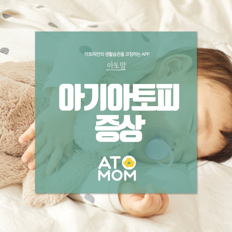  아기아토피 증상 인공지능과 똑똑하게 관리해요