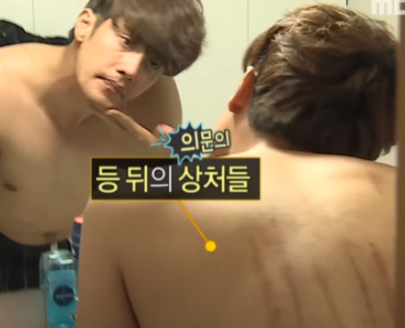 나혼자산다 성훈 키스마크 하차 진실 나혼자산다 성훈 키스마크 하차 진실