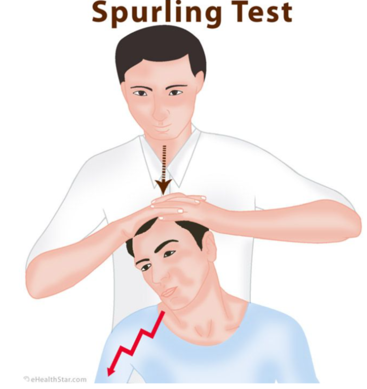  [경추진단]- 스펄링 테스트[Spurling test]