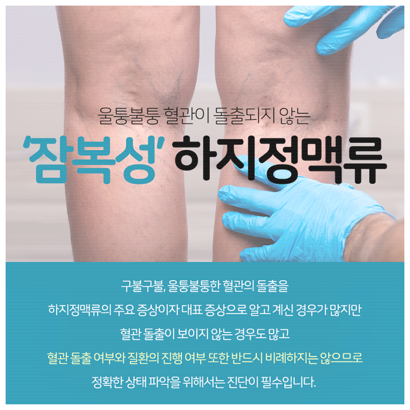 신탄진흉부외과 하지정맥류 전문의 2