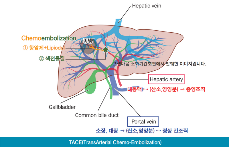 의학용어 TACE 시술 전 간호, 주의사항까지 : 네이버 블로그