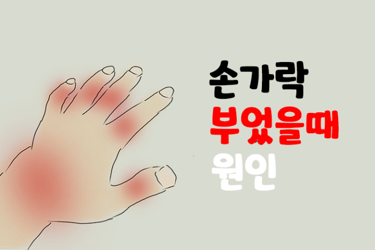  손가락 부었을때 원인 병원