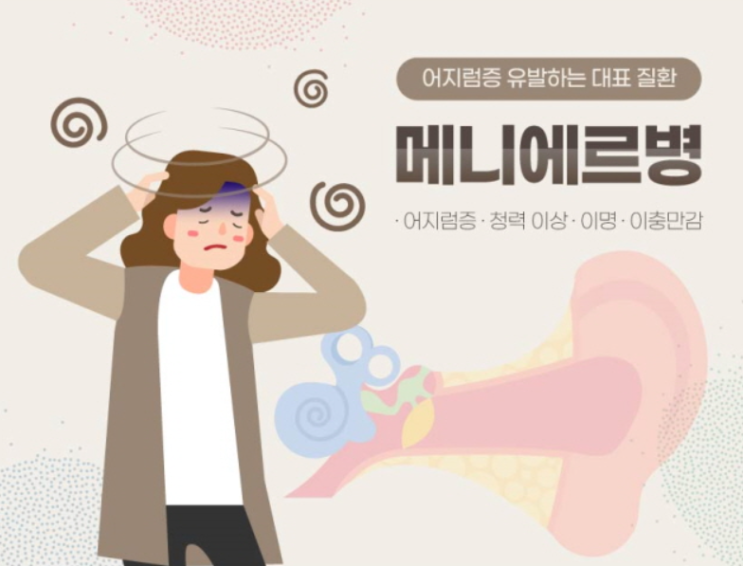  어지럼증 (3) - 메니에르병(Meniere's disease) : 발작적인 어지럼증, 이명, 이충만감, 난청
