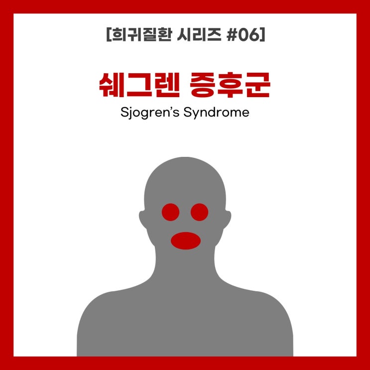  [희귀질환 시리즈 #06] 쉐그렌 증후군