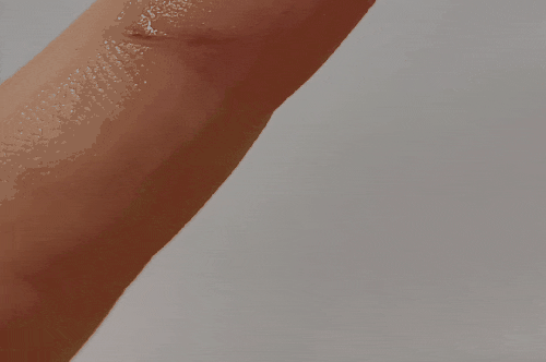  스카티 흉터관리 연고 미리 준비해요