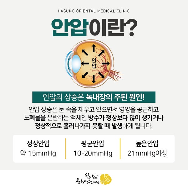 녹내장의 원인! 안압 낮추는 방법 3