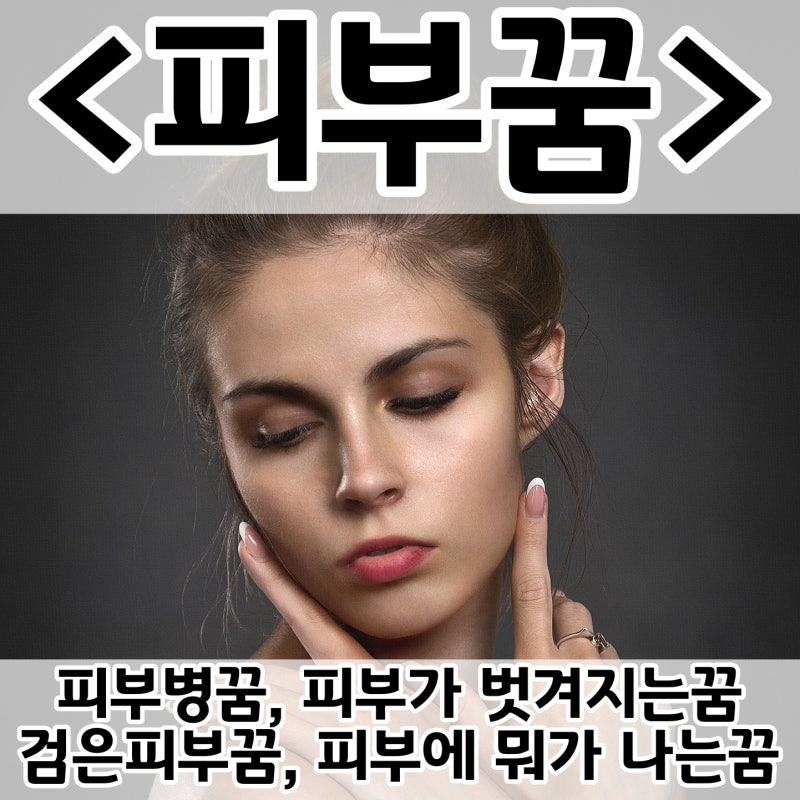 [쉬운 꿈해몽] 피부꿈 :: 피부병꿈, 피부가 벗겨지는꿈, 검은피부꿈, 피부에 뭐가 나는꿈