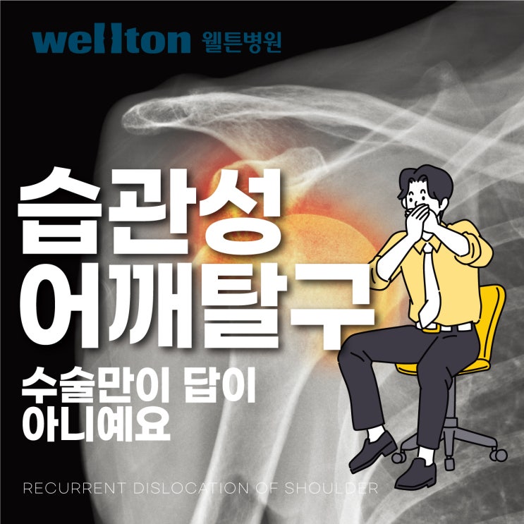  습관성어깨탈구 원인 어깨 관절수술 만이 답이 아니예요