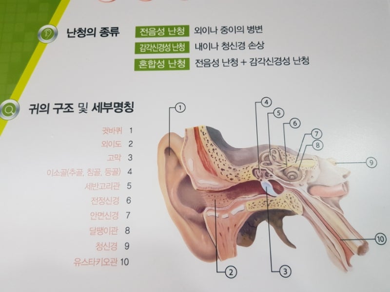 고막이 찢어지거나 구멍이 생기는 고막천공! 인공고막 수술 후에도 보청기 처방. 괴정보청기....