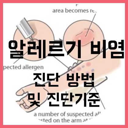 [코] 알레르기 비염- 진단기준 및 진단법