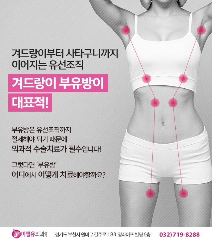 출산 후 겨드랑이 멍, 부유방 증상 개선은 어떻게 할까?