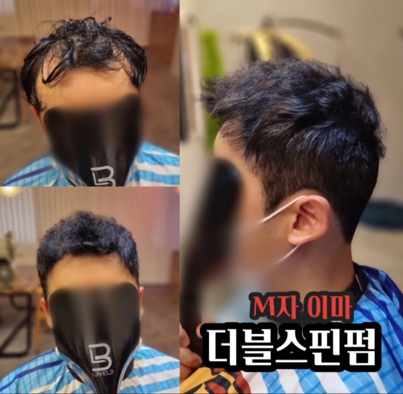 남성 M자형 탈모에 쿨펌!