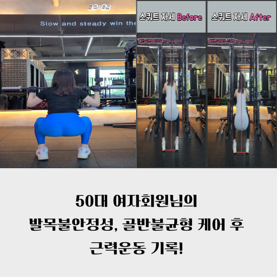  연산동 재활PT 50대 여자 발목불안정성과 골반불균형 케어 후 근력운동(혼자 헬스장가서 운동하기까지)