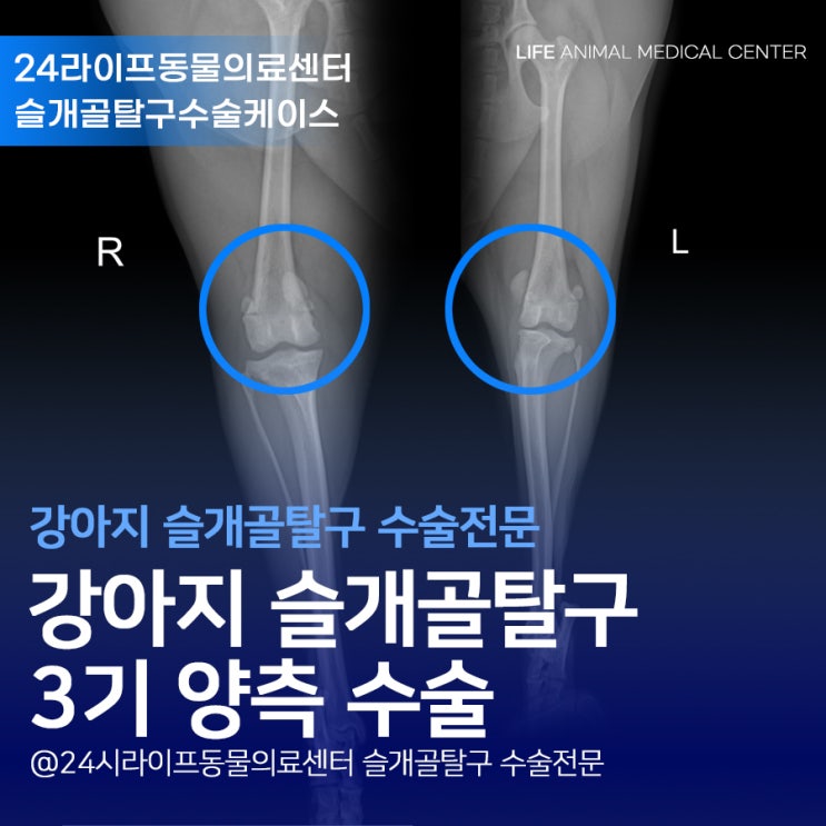 대구강아지슬개골수술 양측 3기 : 강아지가 다리를 삐끗 하고 절어요 대구강아지슬개골수술 양측 3기 : 강아지가 다리를 삐끗 하고 절어요