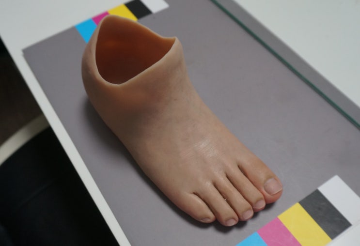  발 절단으로 보행이 어려울 때 도움이 되는 실리콘 맞춤의족