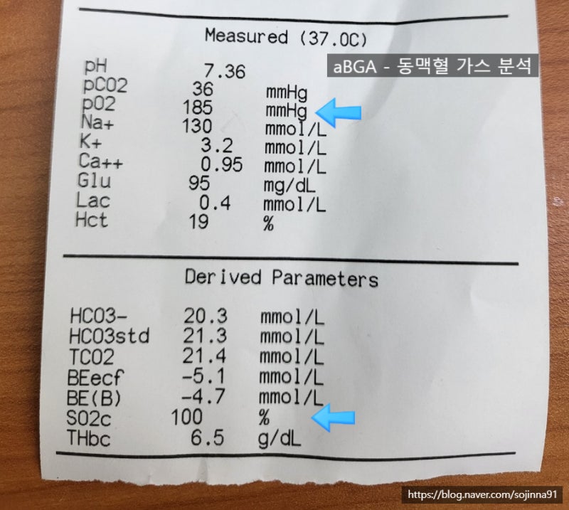 산소포화도 측정하는 방법은? 산소측정기(pulse oximetry)의 사용방법, 주의사항, 저산소증. : 네이버 블로그
