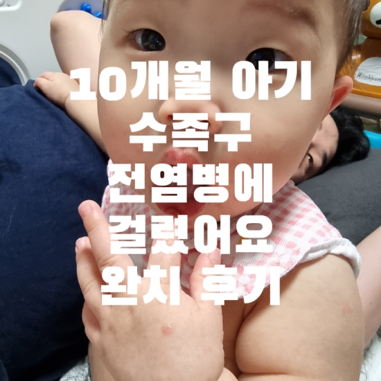  10개월아기 어린이집에서 여름철 수족구 전염병 걸리고 완치한 후기 수족구약 수족구고열 수족구후유증