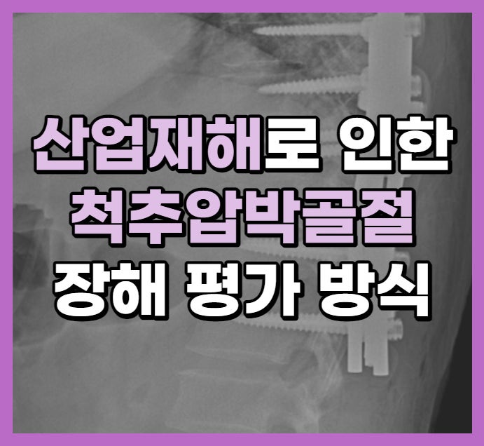 산업재해로 인한 척추압박골절 장해평가 방식