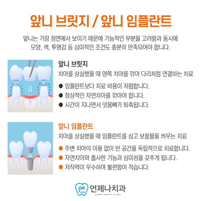양천구 임플란트로 앞니 치료 시 주의사항 4
