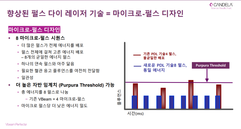 V빔 퍼펙타(V Beam Perfecta) 레이저 출시 2