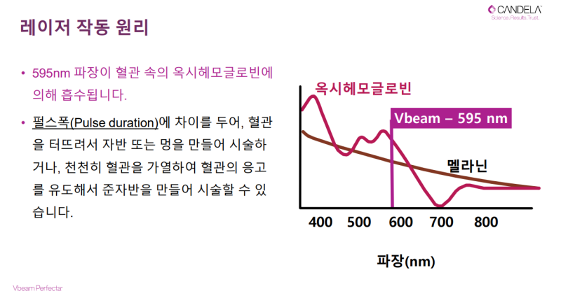 V빔 퍼펙타(V Beam Perfecta) 레이저 출시 4