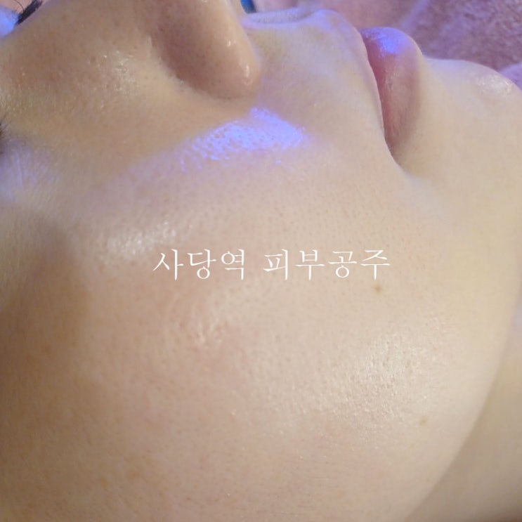  광채 물광피부 추천 사당피부관리