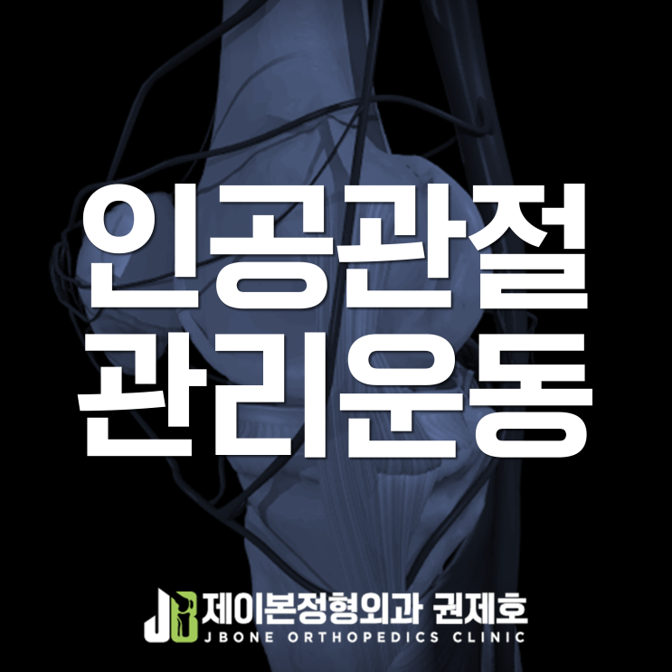 무릎인공관절치환술, 관리와 활동 방법은? feat. 제이본정형외과 권제호