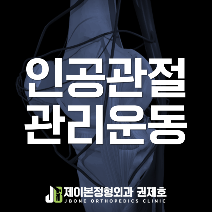  무릎인공관절치환술, 관리와 활동 방법은? feat. 제이본정형외과 권제호