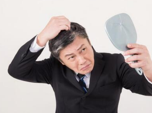  흰머리 나는 위치 알아볼 수 있는 건강상태