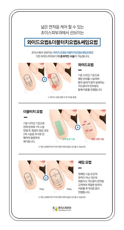 겨드랑이암내제거수술 한번으로 편안 3