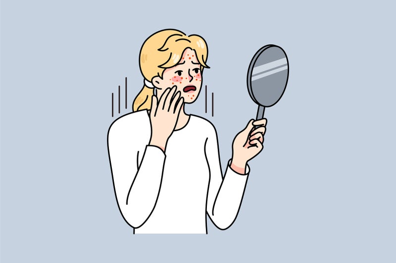 여드름 나는 꿈 (무슨 의미?)