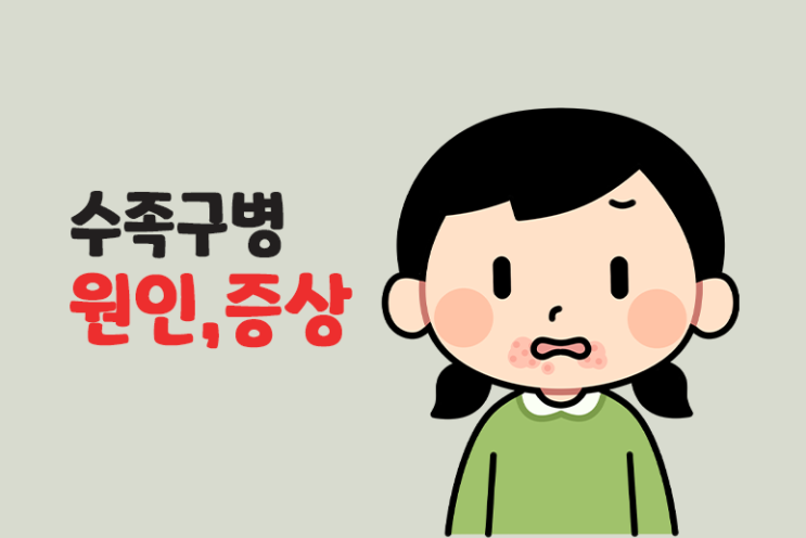  수족구 증상,원인,예방하기 (수족구병)