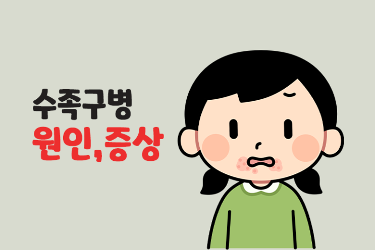 수족구 증상,원인,예방하기 (수족구병)