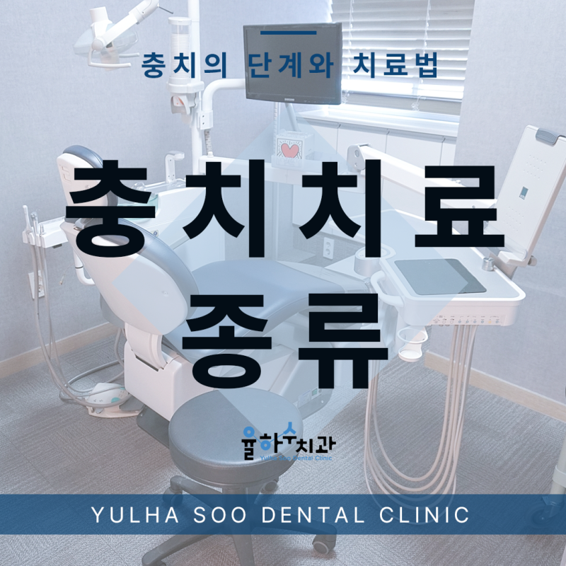 창원 충치 치료 및 수복 유형