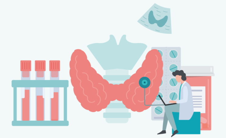  갑상선(Thyroid gland)의 양성 질환 (2) - 그레이브스병(Graves disease), 중독성 다결절성 갑상선종대/갑상선선종, 갑상선 폭풍(Thyroid storm)