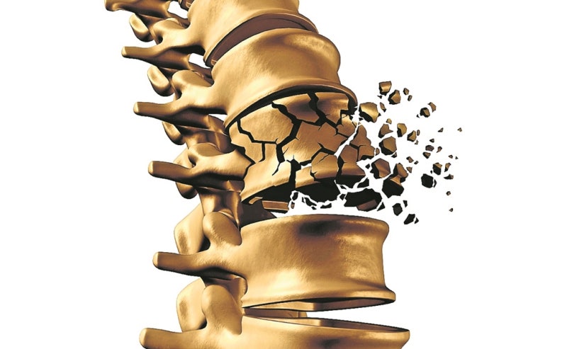 40대와 50대 여성 고유의 요통이란 2