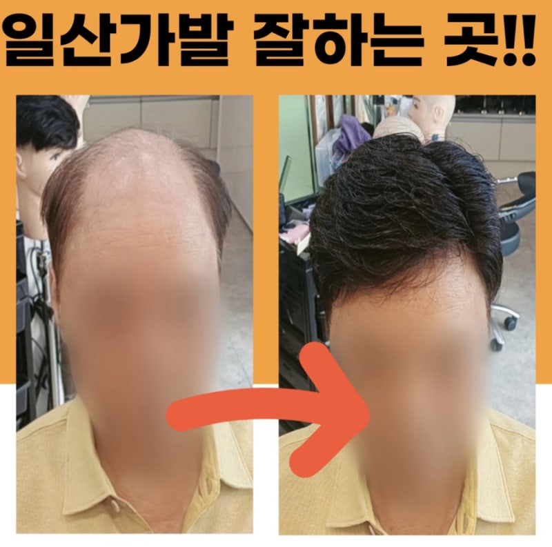 일산 여성가발 일산맞춤가발[띠앙모] 일산 남성가발 일산항암가발