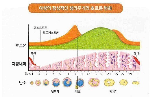  [Q&A] 미레나 삽입 후 부정출혈 매일 있어도 괜찮은가요?  출혈은 보통 어느정도 나오다가 멈추나요?