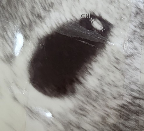 [임심 6주] 아기가 찾아왔어요! + 임신 초기 증상 , 임테기, 초음파사진, 임신진료비 지원