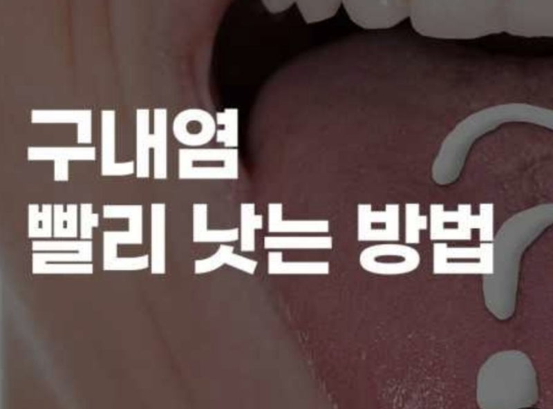 대구/서구 비산동)구내염/입병 