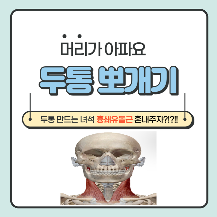  두통을 만드는 녀석. 흉쇄유돌근 혼내주자